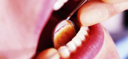 Nieuwe maximumtarieven in de mondzorg